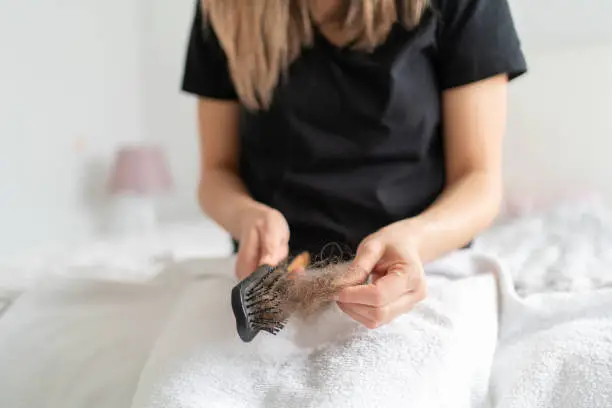 Tudo sobre queda de cabelo feminina.