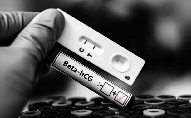 foto de beta-hCG comprovativo de gravidez.